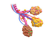 Diseased alveoli, illustration