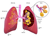 Lungs with alveoli, illustration