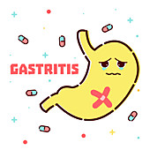 Gastritis, conceptual illustration