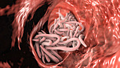 Round worms in human intestine, illustration