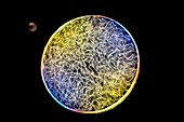 Nostoc cyanobacteria, light micrograph