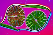 Micrasterias desmid, light micrograph
