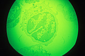 African swine fever virus infecting cell, light micrograph