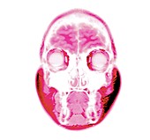 Human head, MRI scan