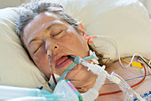 Woman on a ventilator in intensive care