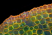 Stoma in pasqueflower epidermis, light micrograph