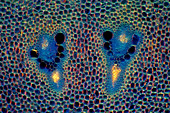 Asparagus raphides and vascular bundles, light micrograph