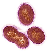 Streptococcus bacteria, TEM