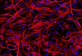 Astrocyte cells, fluorescence light micrograph