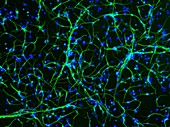 Brain hippocampus neurons, fluorescence light micrograph