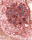Mouse mammary tumour virus, TEM