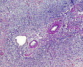 Brown atrophy of myocardium, light micrograph