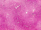 Liver edema, light micrograph