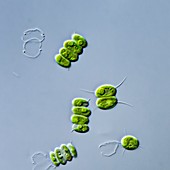 Desmodesmus abundans green alga, LM