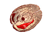 Human brain with highlighted fusiform gyrus, illustration