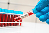 C-reactive protein blood test, conceptual image