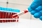 Toxoplasma blood test, conceptual image