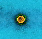 B.1.1.7 variant Covid-19 coronavirus particle, TEM