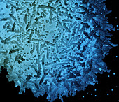 Cell infected with SARS-CoV-2 particles, SEM