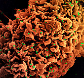 Cell infected with B.1.1.7 variant coronavirus, SEM