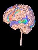 Brain activity during a visual language task, fMRI scan