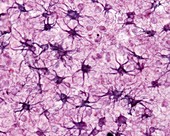 Astrocytes, light micrograph