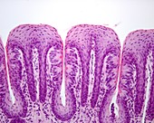 Foliate papillae with taste buds, light micrograph