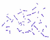Human karyotype, light micrograph