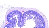 Duodenum, light micrograph