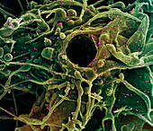 Cell infected by SARS-CoV-2 virus particles, SEM