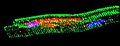 Transcription factor in heart muscle, light micrograph