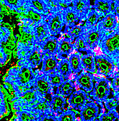 Antigen presenting cells in the colon, light micrograph