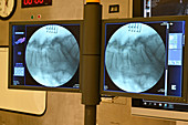 X-rays taken during surgery