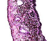 Iris of the eye, light micrograph