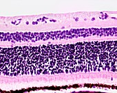 Retina layers, light micrograph