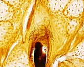 Hair innervation, light micrograph