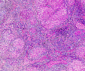 Liver obstructive jaundice, light micrograph