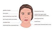 Facial wrinkles, illustration