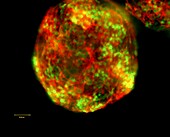 CRISPR-Cas9 engineering in neurons, fluorescent micrograph