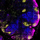 Lymph node, fluorescent light micrograph