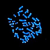 Telomeres on chromosomes, fluorescent light micrograph