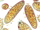 Bacteriophages infecting E.coli cells, TEM