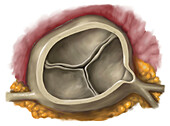 Healthy aortic valve, illustration