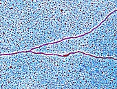 DNA forming a replication fork, TEM