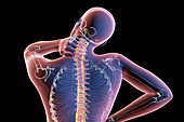 Human neck pain, illustration