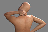 Human neck pain, illustration