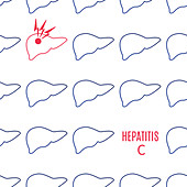 Hepatitis C, conceptual illustration