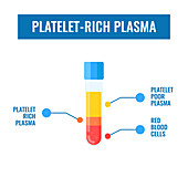Platelet-rich plasma, illustration