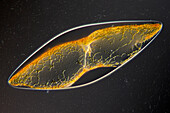 Pyrocystis sp., light micrograph
