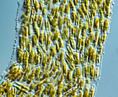 Paribellus sp. diatoms, LM